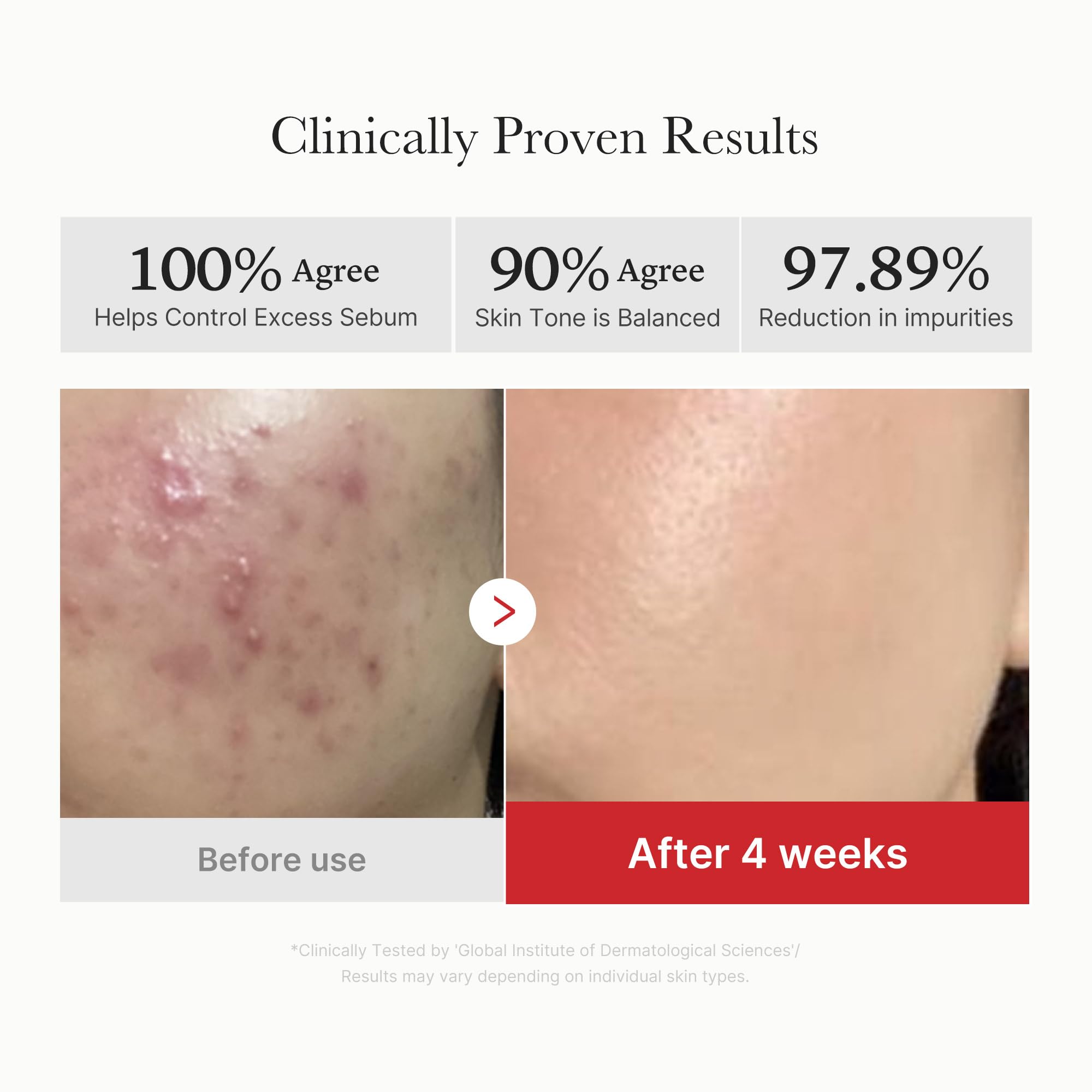 medicube Zero Pore Pads 2.0, Dual-Textured Facial Toner Pads for Exfoliation and Pore Care with 4.5% AHA Lactic Acid & 0.45% BHA Salicylic Acid, Ideal for All Skin Types, Korean Skin Care (70 Units)