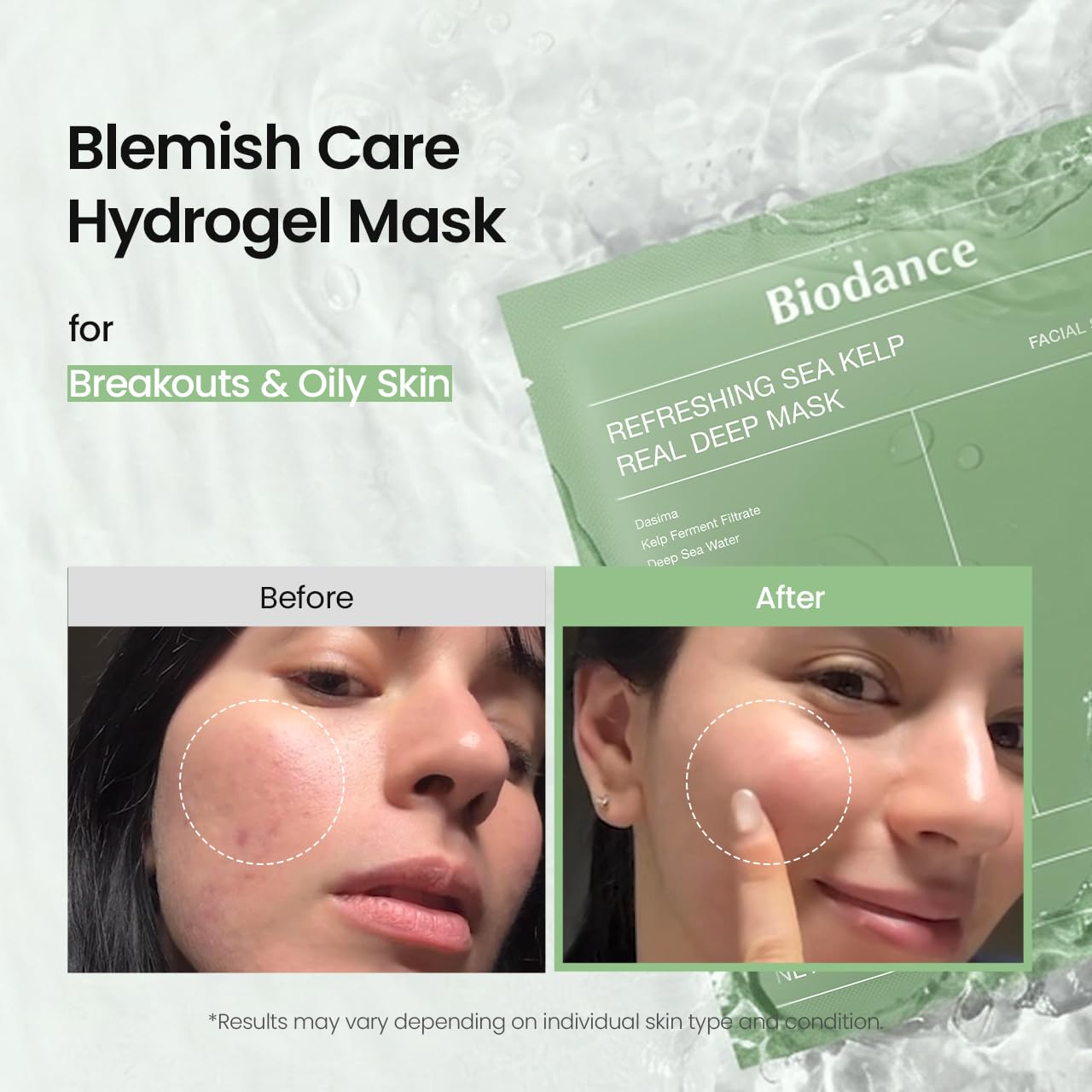 BIODANCE Bio-Collagen Real Deep Face Mask 4 Pcs | Hydrogel Overnight Mask | Pore Minimizing and Elasticity Improvement | Korean Face Mask for Glass Skin | Korean Skincare