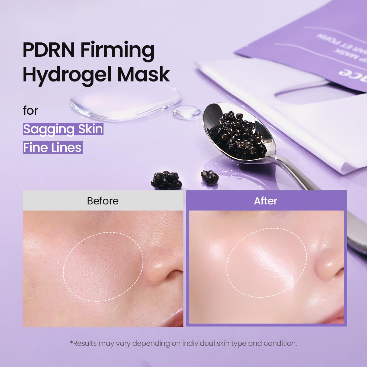 BIODANCE Bio-Collagen Real Deep Face Mask 4 Pcs | Hydrogel Overnight Mask | Pore Minimizing and Elasticity Improvement | Korean Face Mask for Glass Skin | Korean Skincare